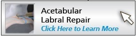 acetabular-labral