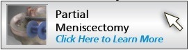 partial-meniscectomy