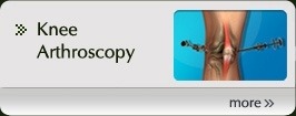 Knee Arthroscopy