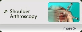 Shoulder Arthroscopy