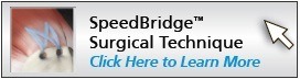speed-bridge