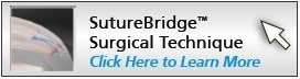 suture-bridge-surgical-tech