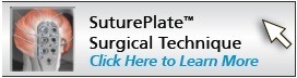suture-plate
